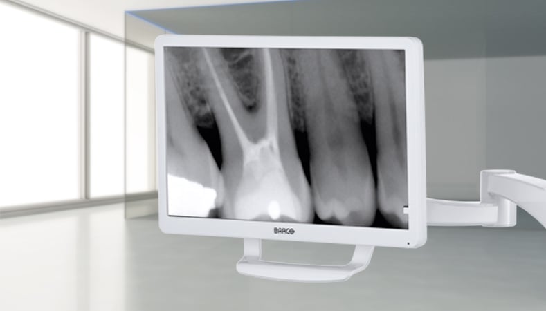 Castellini monitor